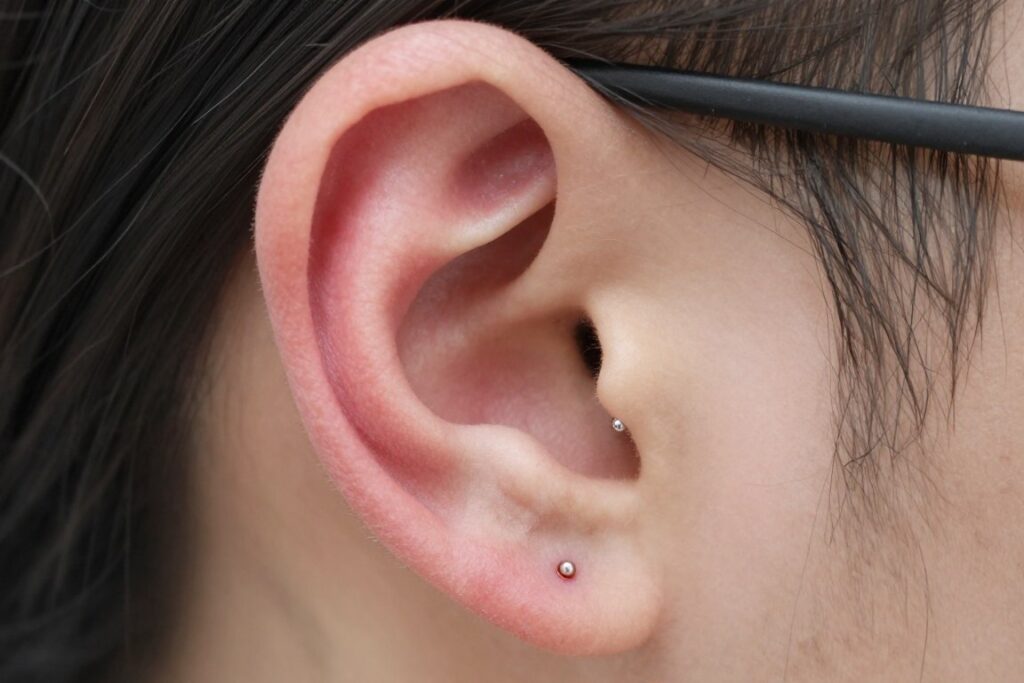 reakcja alergiczna na biżuterię zawierającą nikiel pokazująca czerwoną skórę